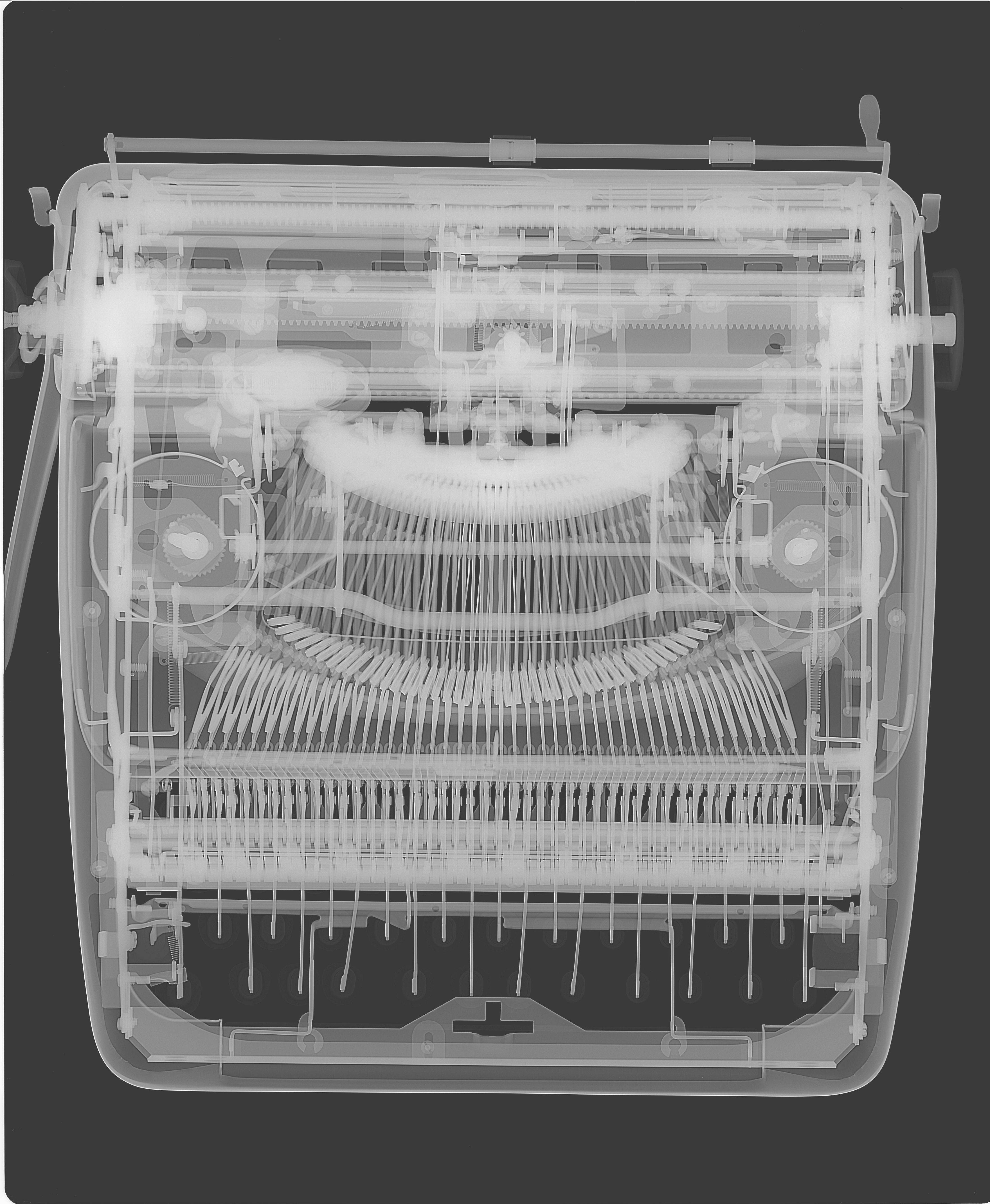 Computed Radiography